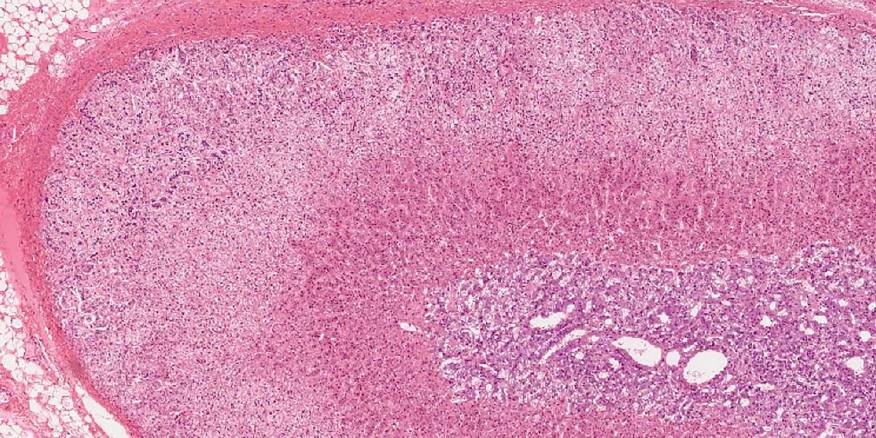 Le patologie orali nella pratica clinica