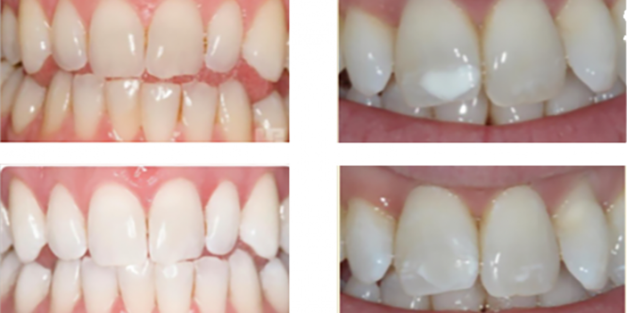 L’estetica del sorriso